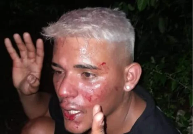 Karlos Deyvide Costa Nascimento