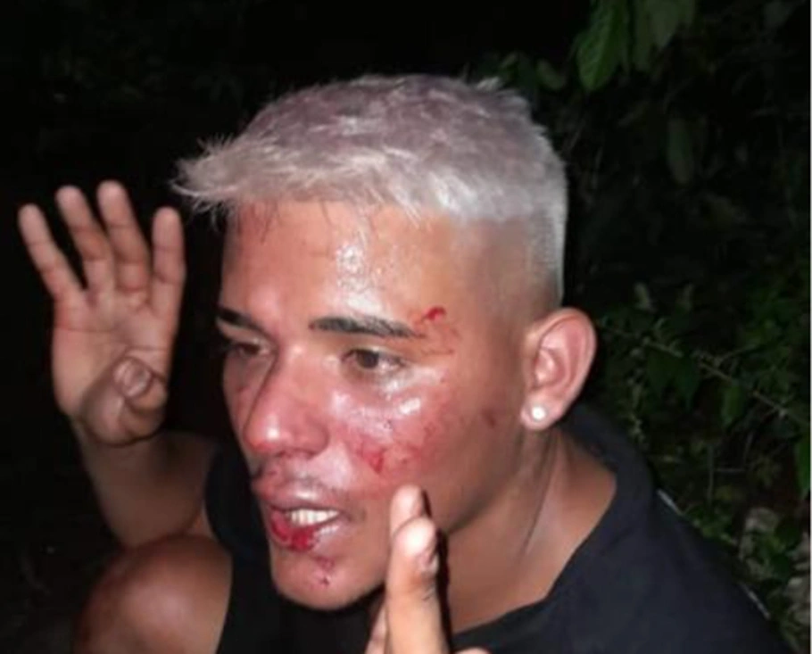 Karlos Deyvide Costa Nascimento