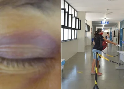 A vítima teve o supercílio cortado após sofrer agressão no Lineu Araújo