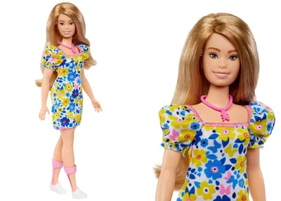 Boneca Barbie com síndrome de Down.