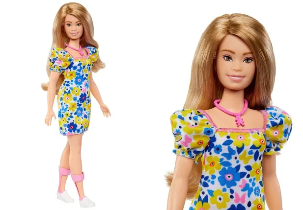 Boneca Barbie com síndrome de Down.