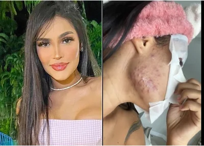 Cantora Flay choca web após mostrar reação ao chip da beleza
