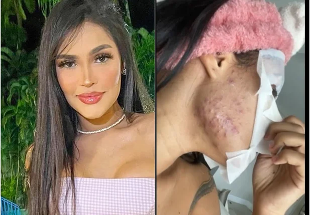 Cantora Flay choca web após mostrar reação ao chip da beleza