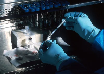 CAR-T Cell vem sendo desenvolvida pela USP