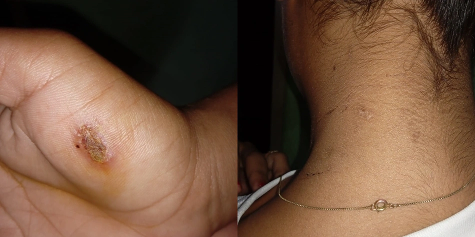 Crianças com hematomas das agressões