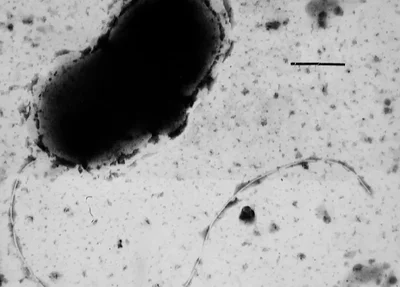 Doença de Parkinson pode ser causada por bactéria intestinal