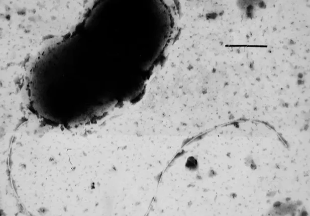 Doença de Parkinson pode ser causada por bactéria intestinal