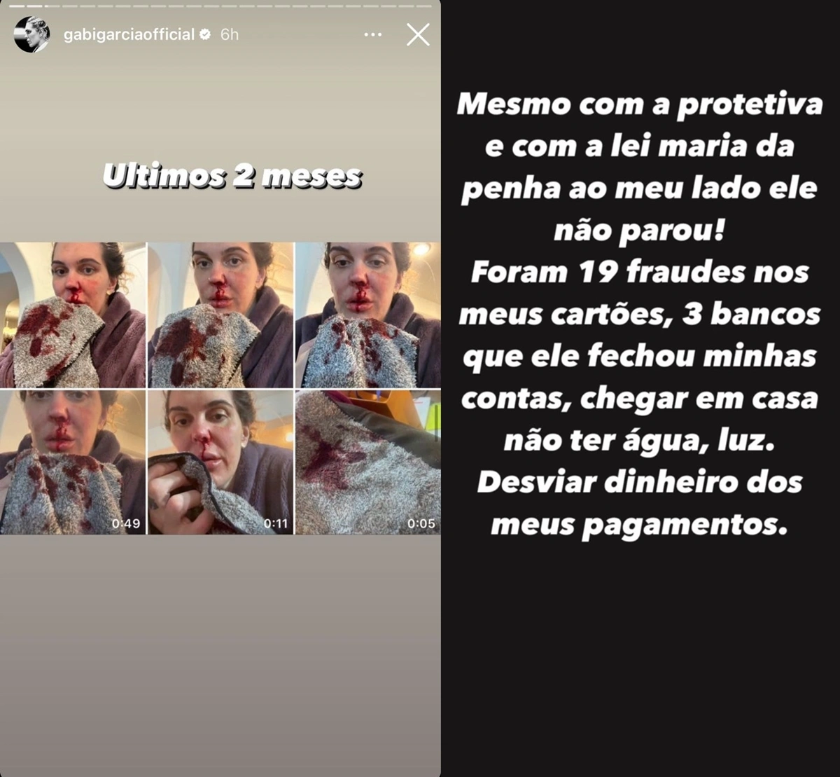 Gabi Garcia denúncia ex-marido por agressão