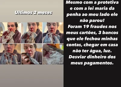 Gabi Garcia denúncia ex-marido por agressão