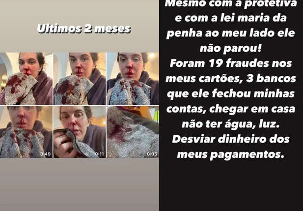 Gabi Garcia denúncia ex-marido por agressão