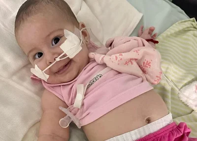Maria Victoria, que com 5 meses foi diagnostificada com AME.