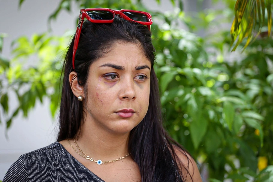 Pâmela Xavier concede entrevista à imprensa para falar sobre o caso de violência que sofreu na madrugada de sábado (13)