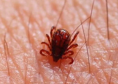 Febre maculosa