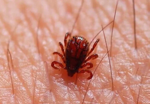 Febre maculosa