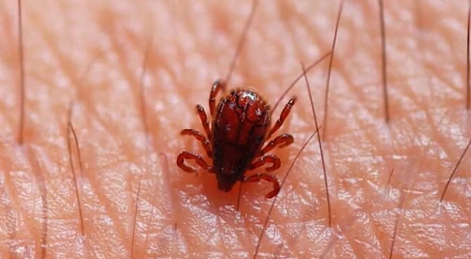 Febre maculosa