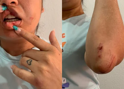 Marcas das agressões
