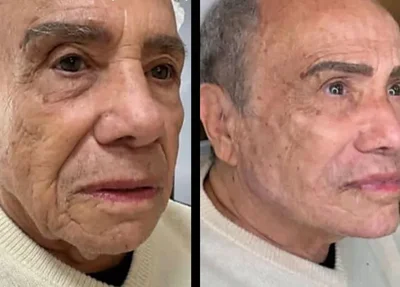O ator Stênio Garcia compartilhou o resultado em suas redes sociais