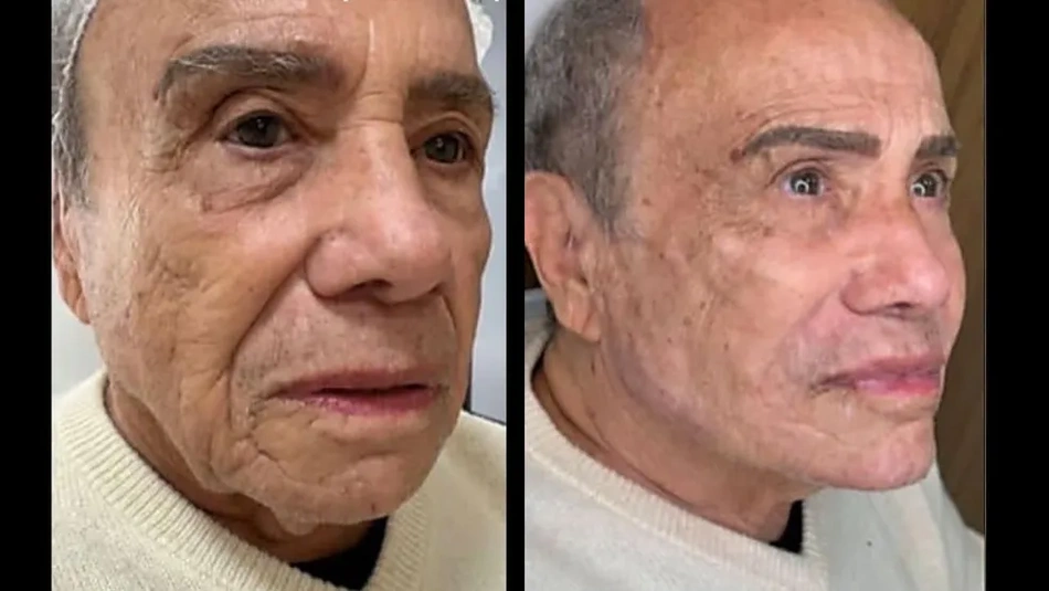 O ator Stênio Garcia compartilhou o resultado em suas redes sociais