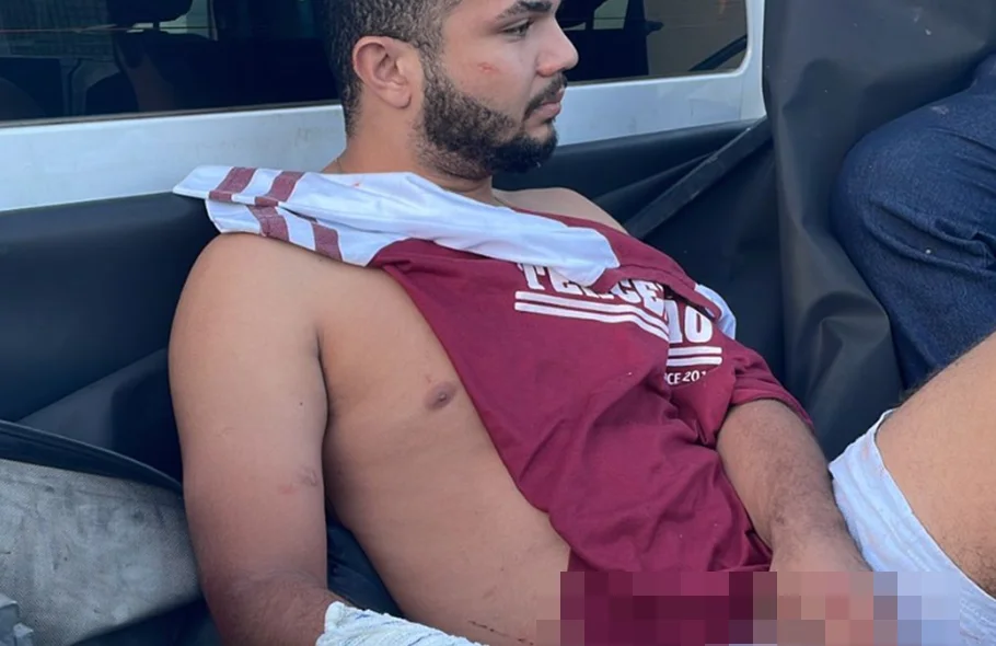 Suspeito quebrou o braço ao tentar fugir da polícia