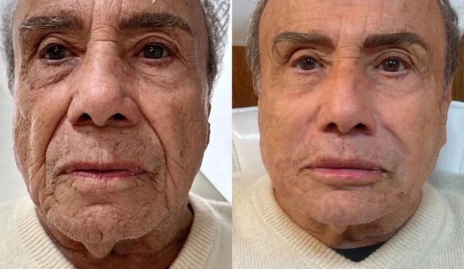 Veja o antes e depois de Stênio Garcia