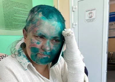 Jornalista russa Elena Milachina atacada por um grupo de homens mascarados e armados.