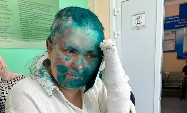 Jornalista russa Elena Milachina atacada por um grupo de homens mascarados e armados.