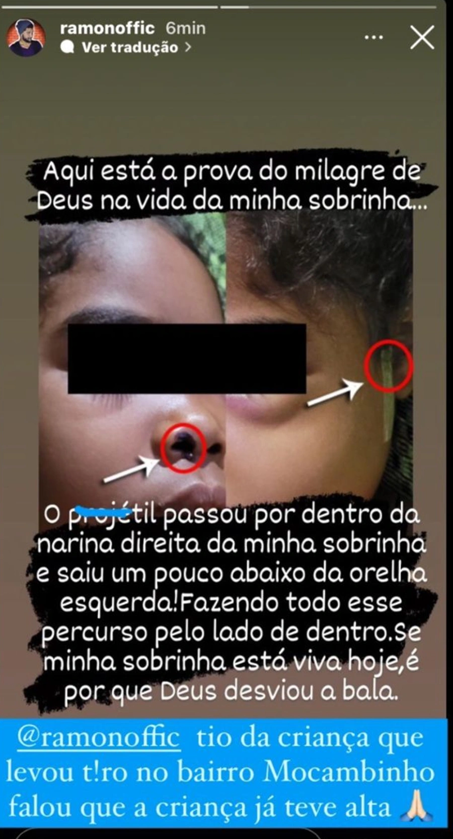 No Instagram, o tio da criança noticiou a alta da menina.