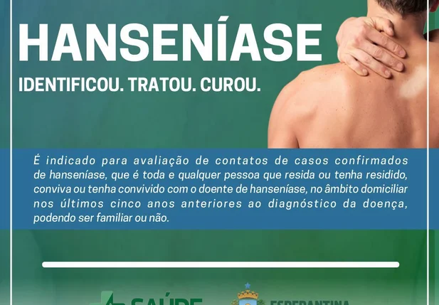 Prefeitura de Esperantina anunciou que está realizando testes rápidos para diagnosticar a hanseníase