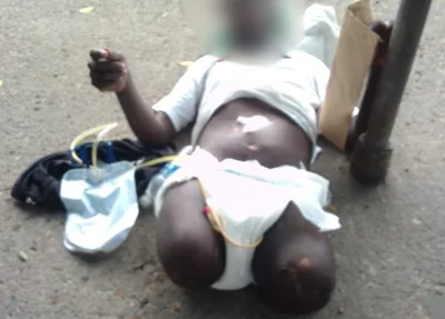 Um paciente que teve as pernas amputadas foi abandonado na rua no Rio de Janeiro