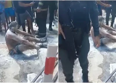 Homem teve partes do corpo queimadas