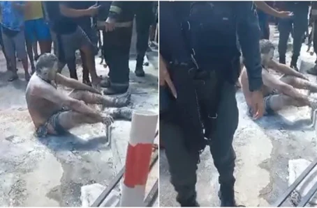 Homem teve partes do corpo queimadas