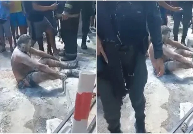 Homem teve partes do corpo queimadas