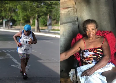 Maria da Conceição da Cunha Bispo antes e depois do acidente