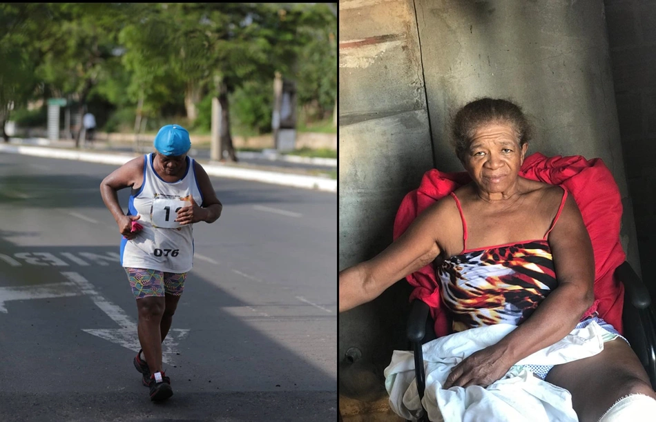 Maria da Conceição da Cunha Bispo antes e depois do acidente