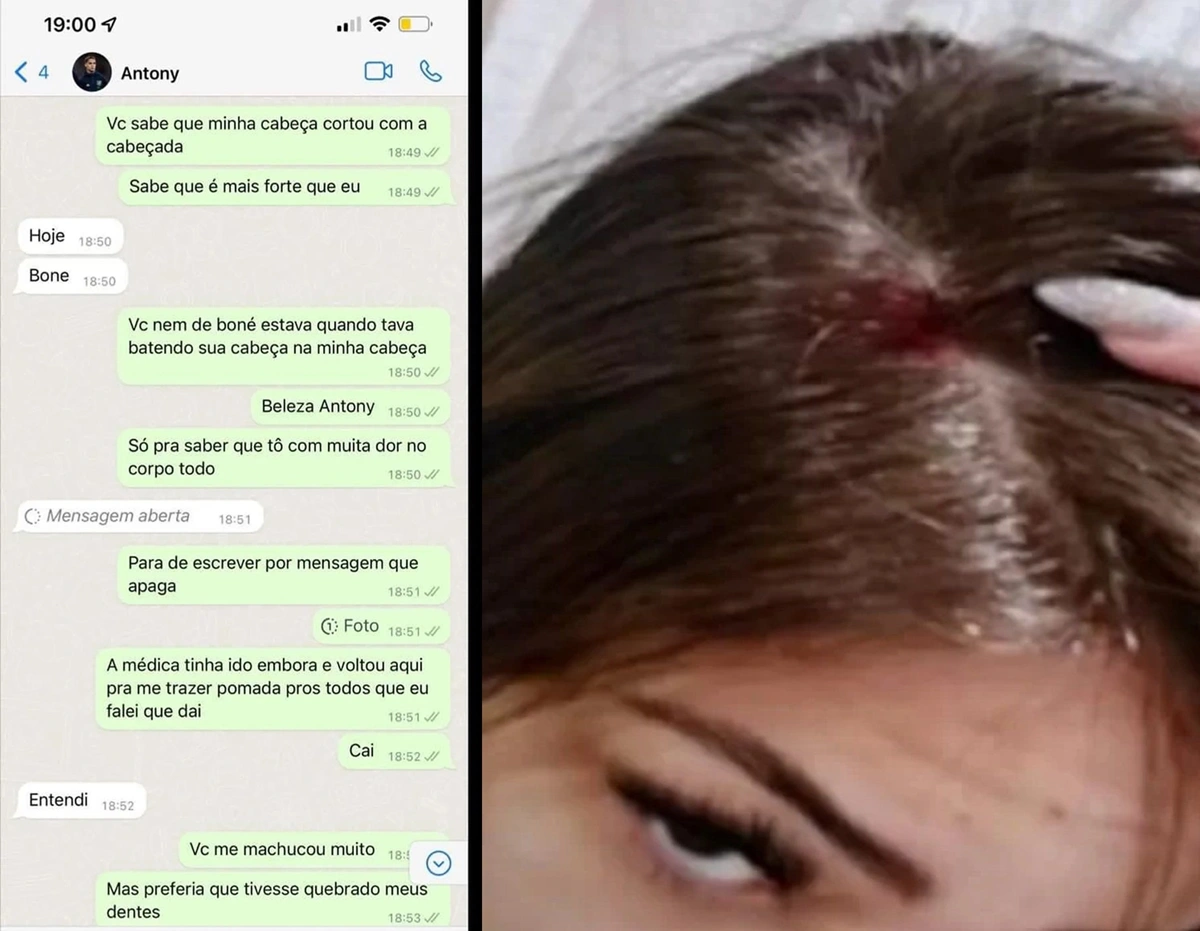 Agressão de Antony teria causado corte na cabeça de Gabriela