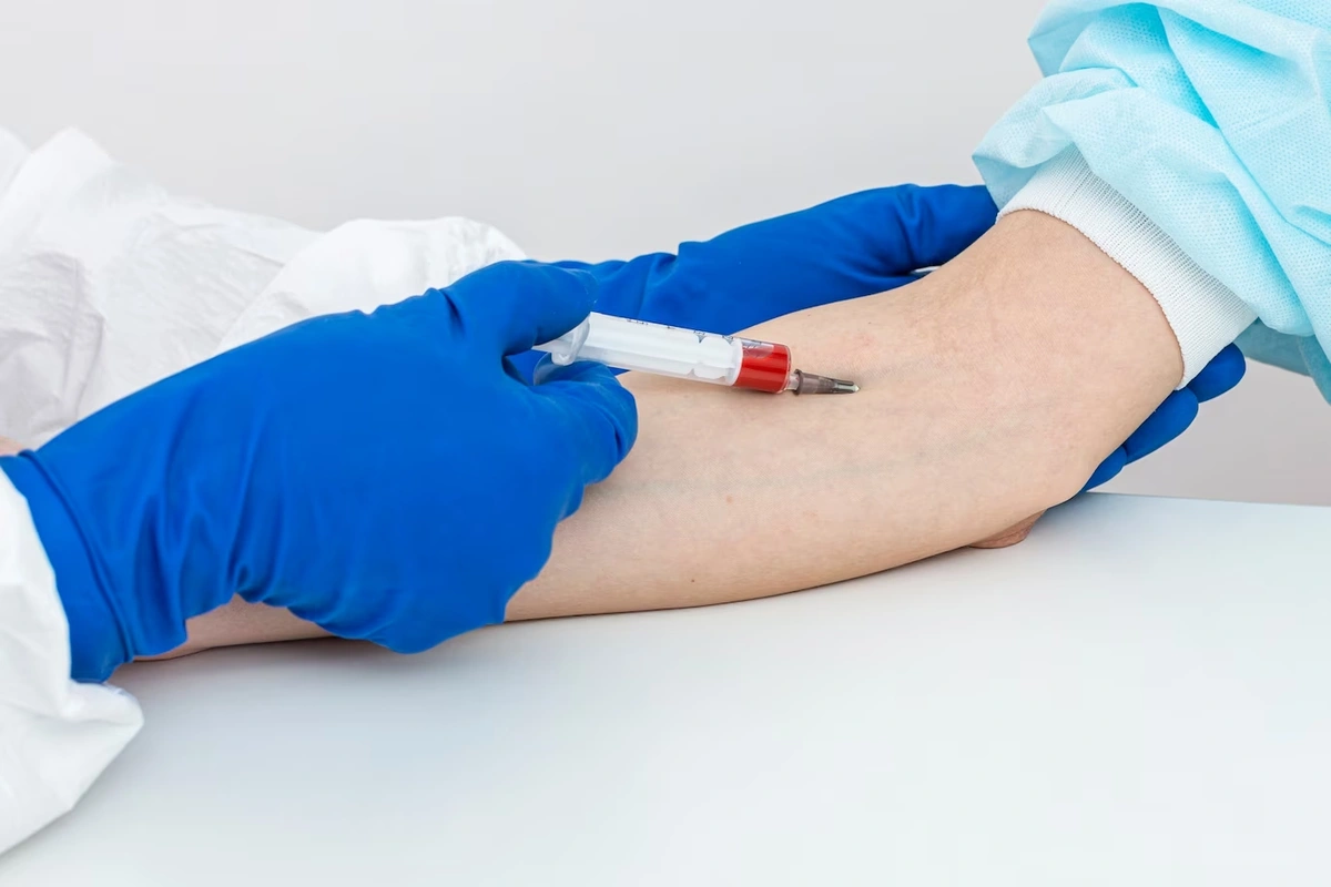 Novo exame de sangue que ajuda a detectar o Alzheimer chega ao Brasil