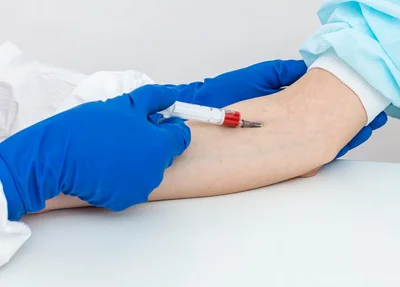 Novo exame de sangue que ajuda a detectar o Alzheimer chega ao Brasil