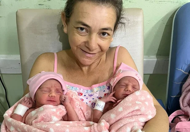Paciente da Nova Maternidade dá à luz gêmeas em gestação extremamente rara