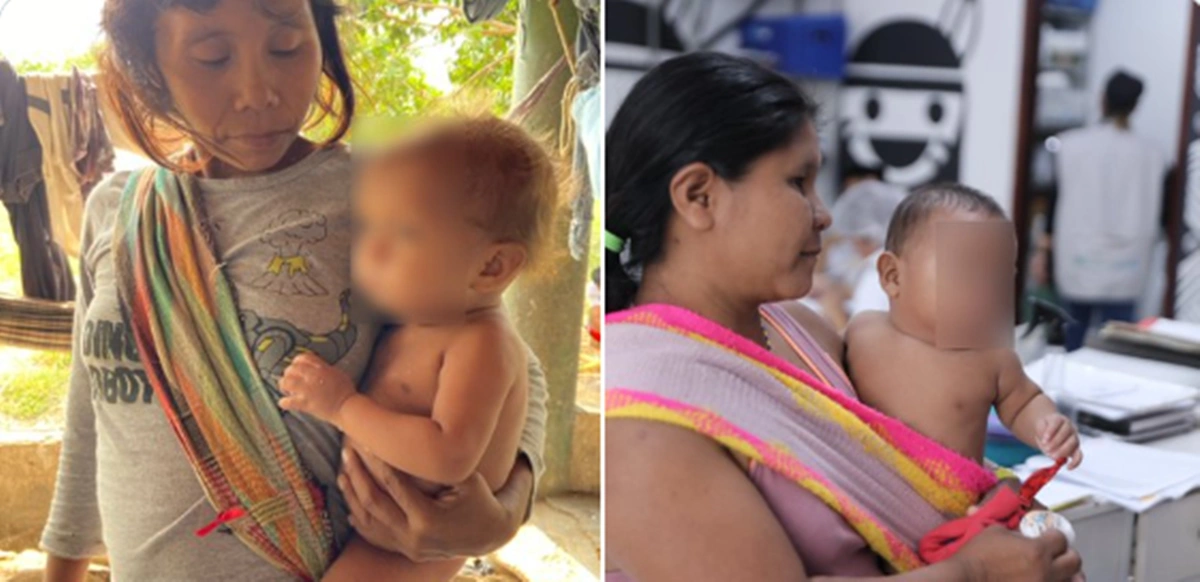 Bebês yanomamis são resgatados pelo Ministério da Saúde