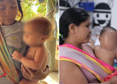 Bebês yanomamis são resgatados pelo Ministério da Saúde
