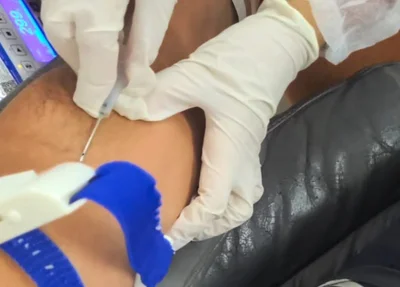Doação de sangue