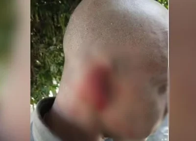 PM teve parte da orelha arrancada em abordagem policial