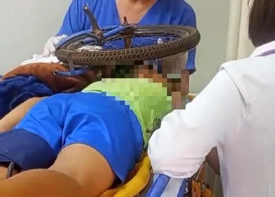 A roda ficou presa ao crânio da criança