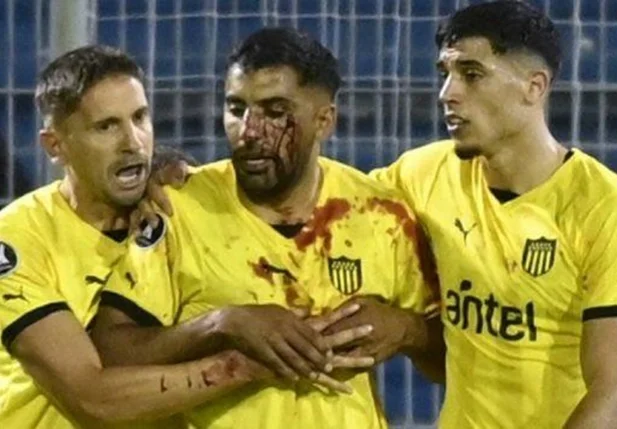 Jogador do Peñarol é atingido por pedra