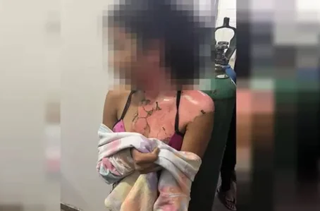 Vítima foi queimada com água quente pela tia no DF