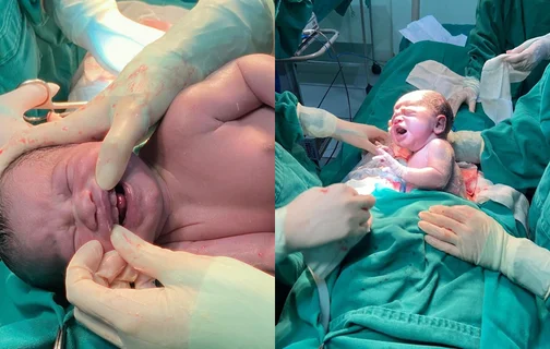 Bebê nasce com seis dentes e surpreende equipe médica