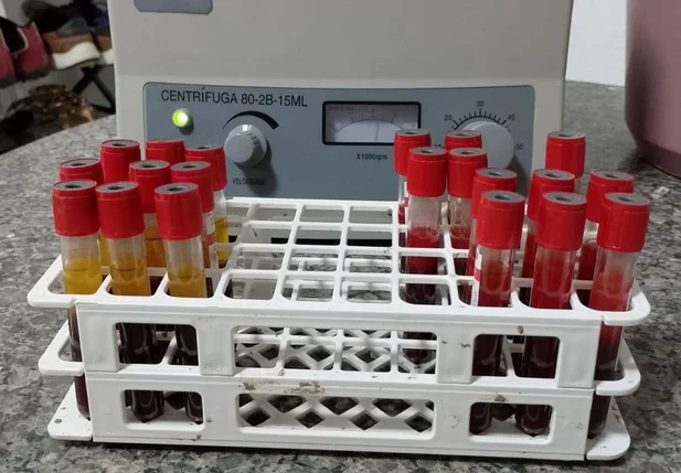 Estudo sobre a febre aftosa no Piauí