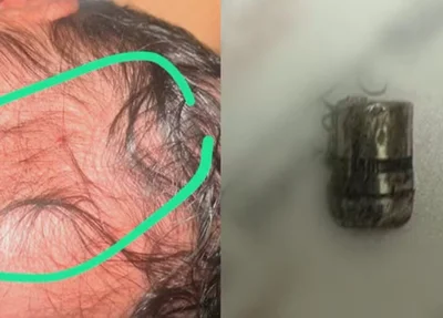 Projétil encontrado ao lado da bebê