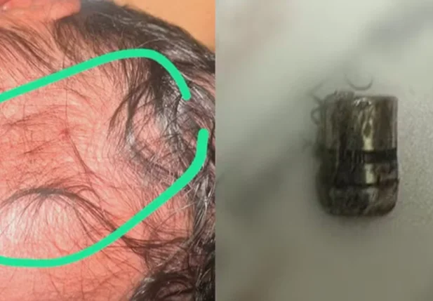 Projétil encontrado ao lado da bebê