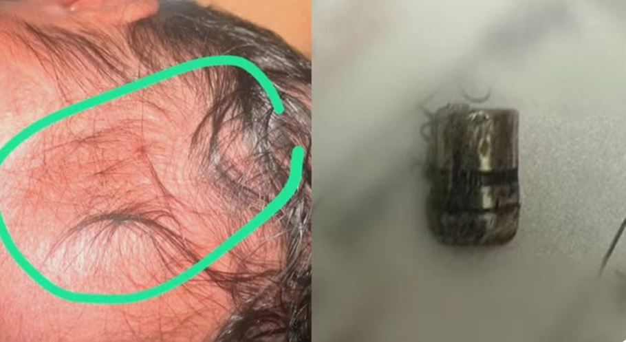 Projétil encontrado ao lado da bebê